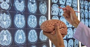 How to Become a Neurosurgeon?