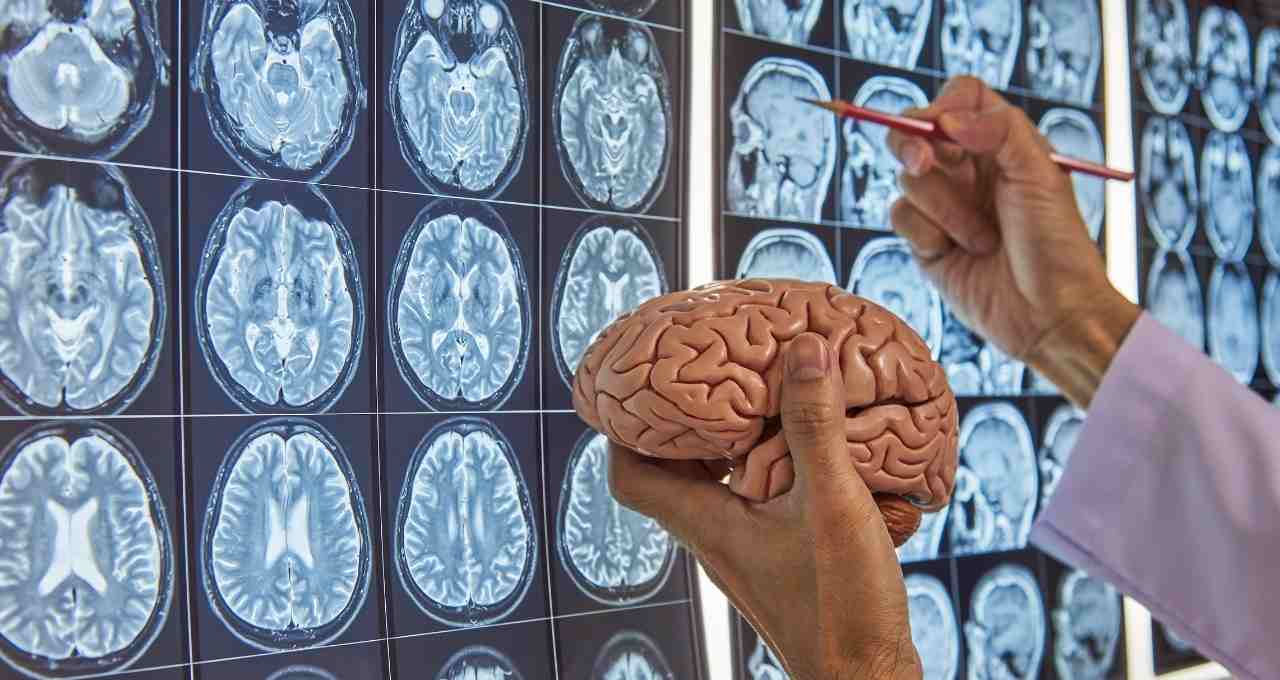 How to Become a Neurosurgeon?